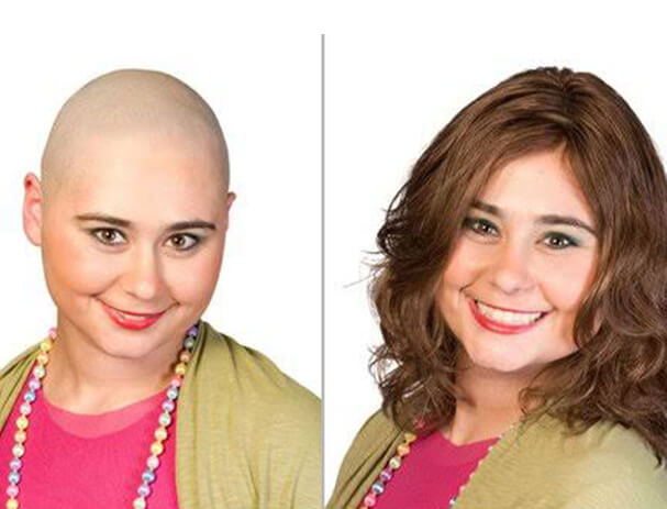 Best wigs for chemo patients in Bangalore